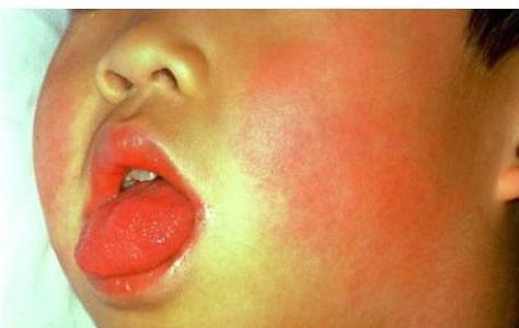 img-189.jpeg|294x185