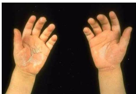 img-190.jpeg|302x209