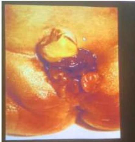 img-209.jpeg|259x272