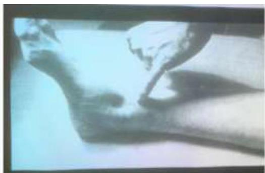 img-211.jpeg|186x210