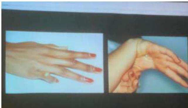 img-220.jpeg|402x231