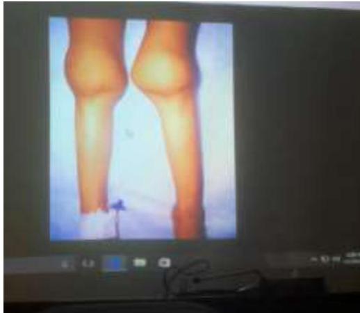 img-221.jpeg|303x263