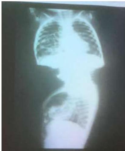 img-228.jpeg|306x370