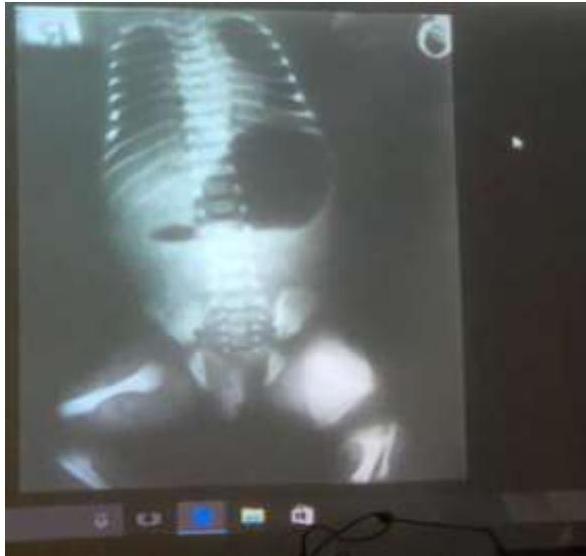 img-236.jpeg|261x248