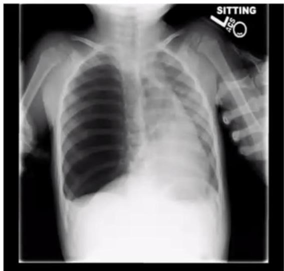 img-277.jpeg|398x380