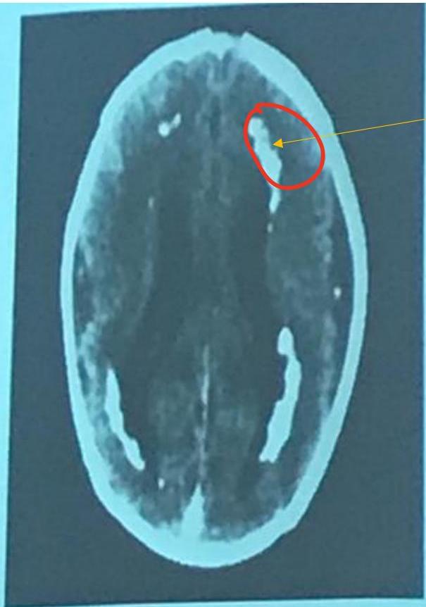 img-280.jpeg|216x308