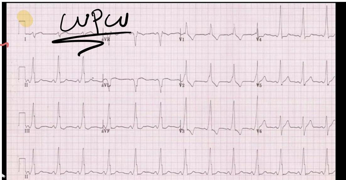 img-310.jpeg|614x319