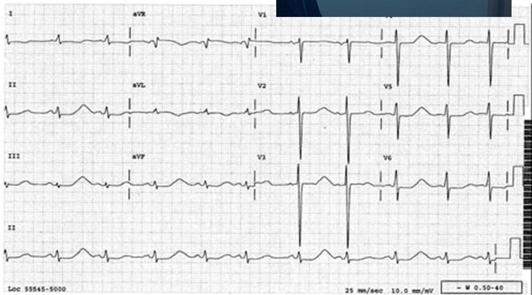 img-312.jpeg|437x242