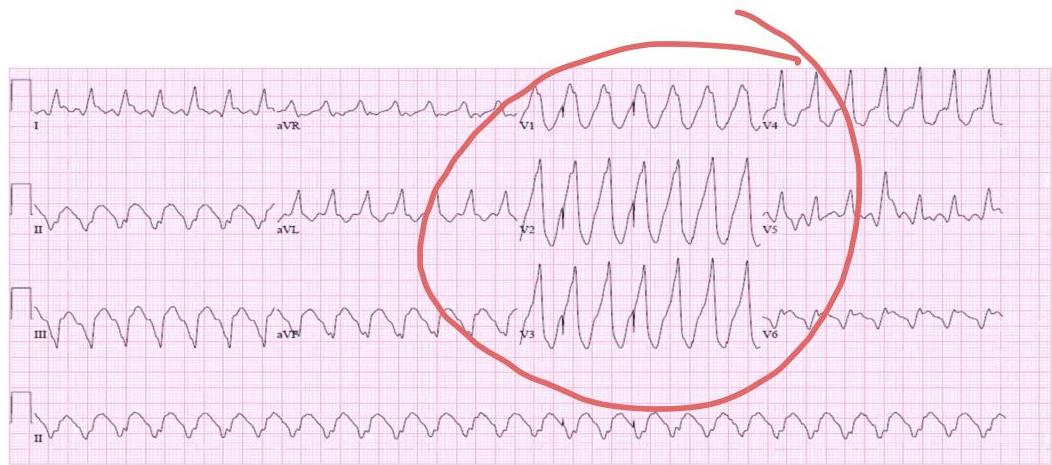 img-314.jpeg|437x193