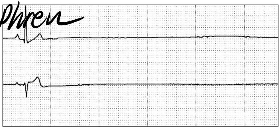 img-316.jpeg|357x163