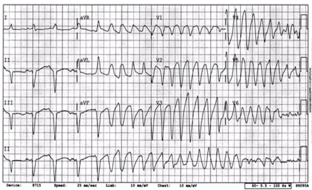 img-325.jpeg|464x283