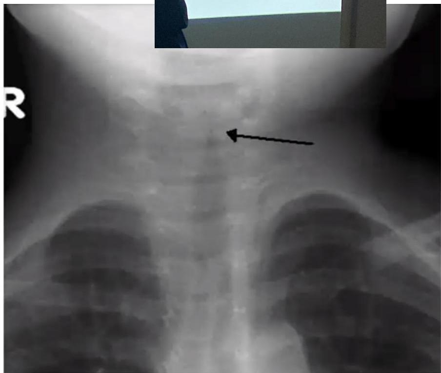 img-331.jpeg|262x222