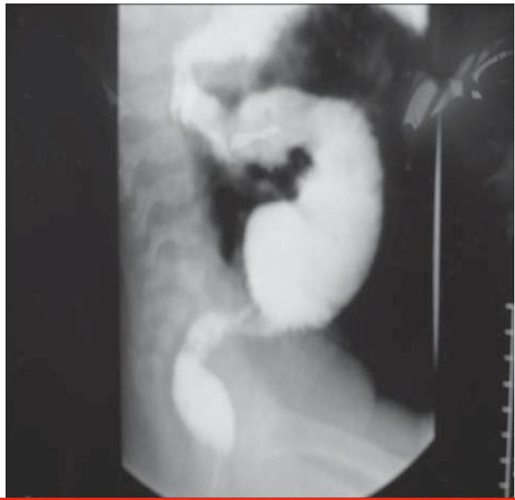 img-334.jpeg|285x276