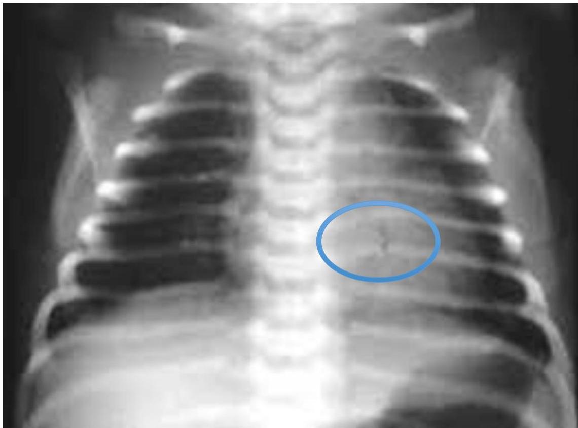 img-344.jpeg|320x237