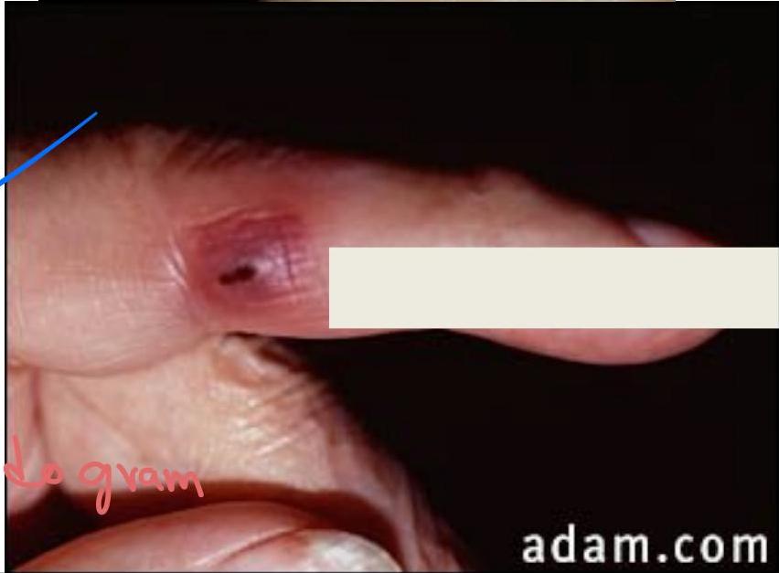 img-361.jpeg|254x187