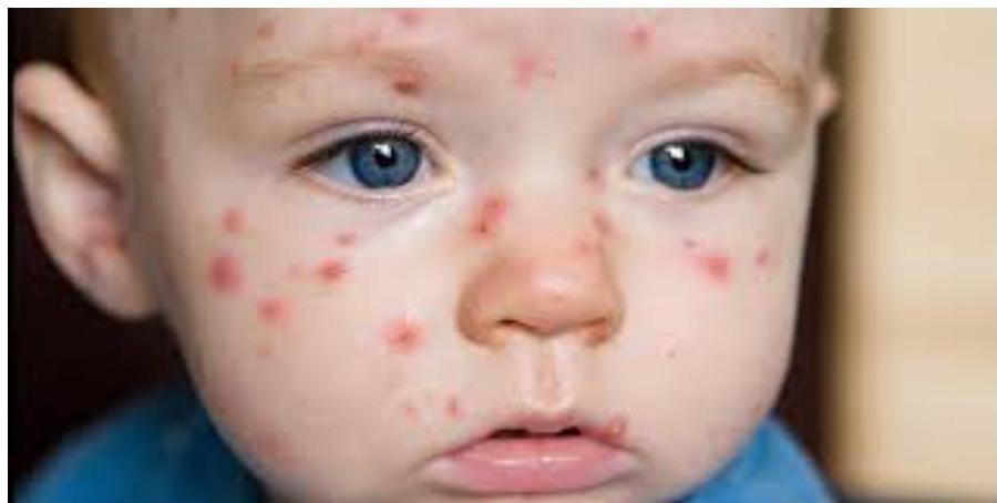 img-371.jpeg|359x181