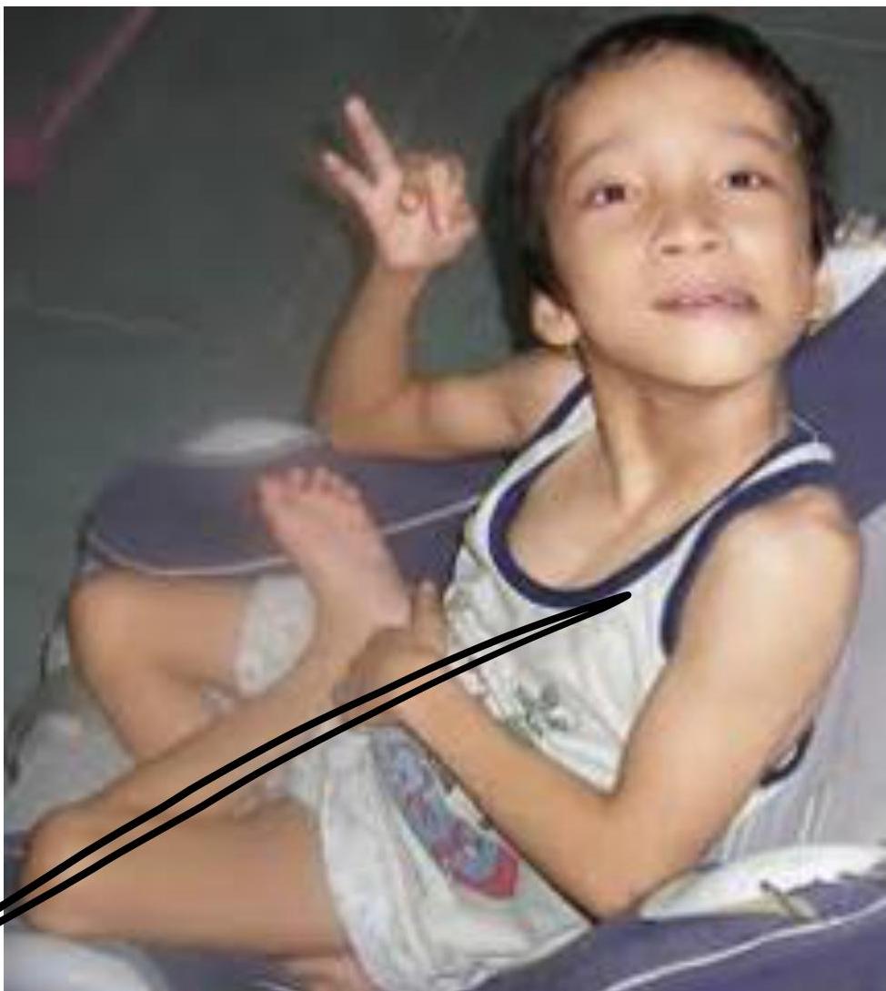 img-395.jpeg|218x244