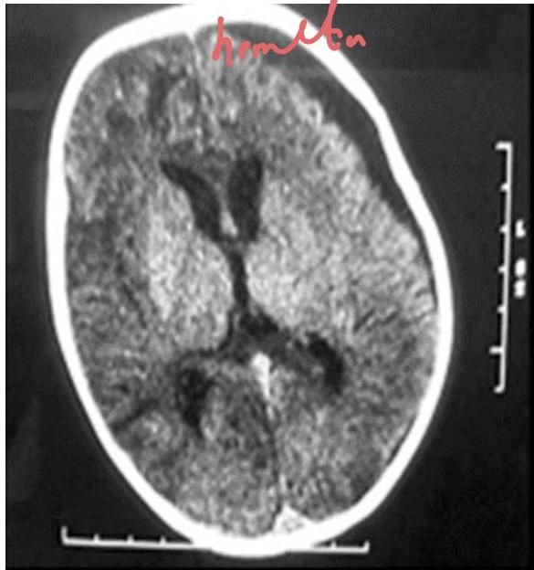 img-403.jpeg|191x204