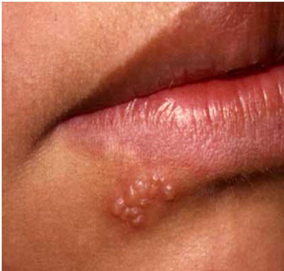 img-409.jpeg|257x245