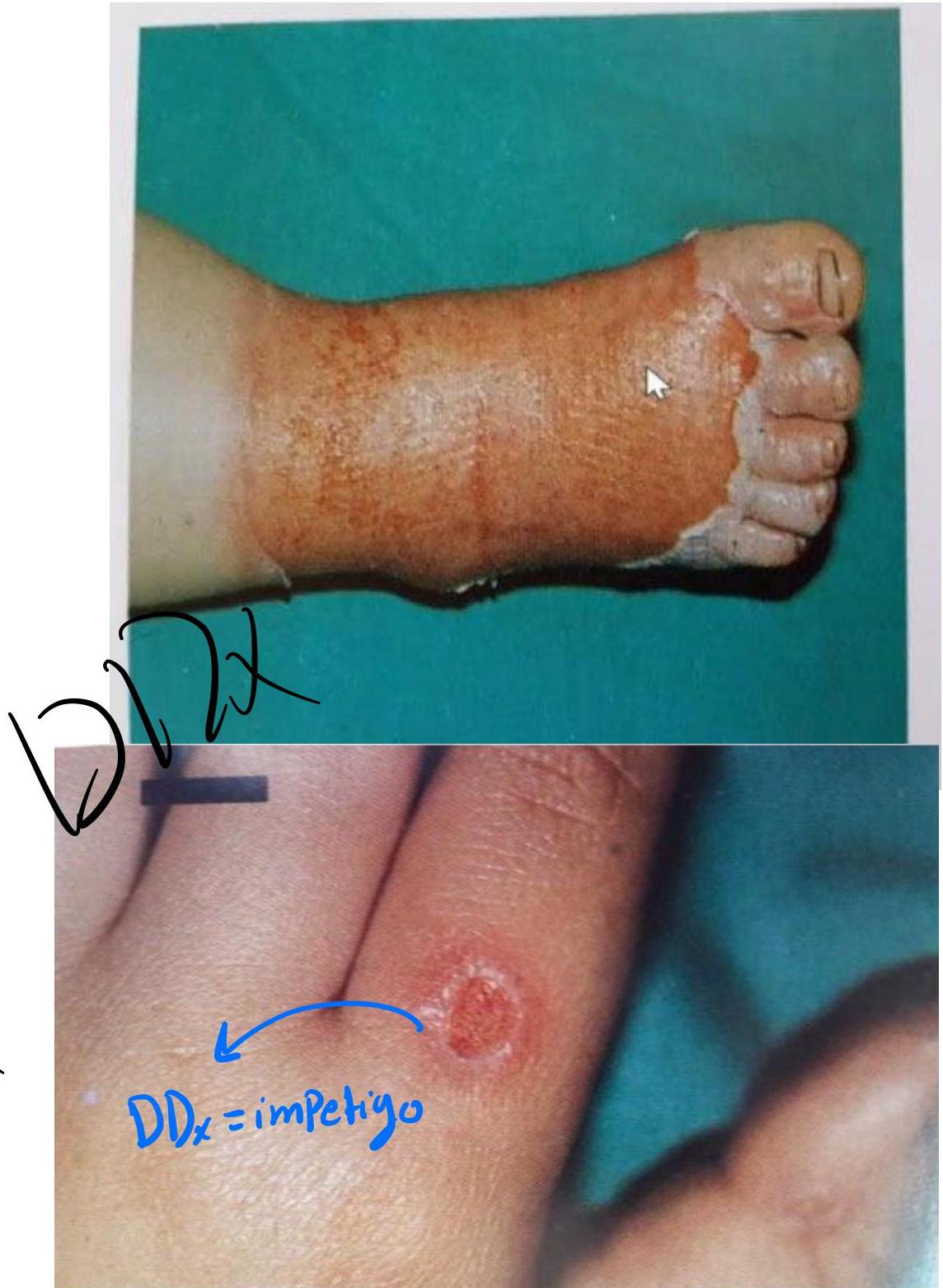 img-410.jpeg|218x297