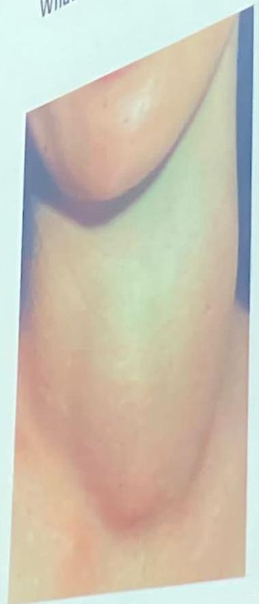 img-413.jpeg|352x377