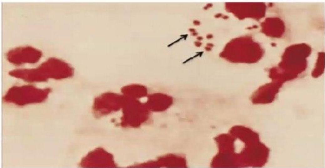 img-421.jpeg|322x167