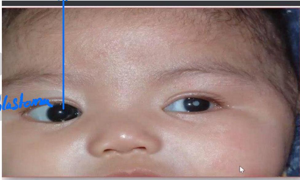 img-423.jpeg|382x229