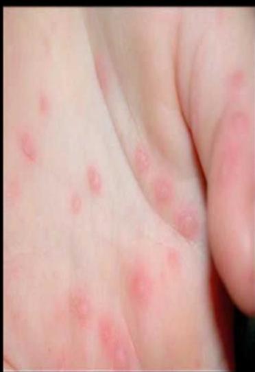 img-433.jpeg|241x192