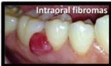 TSC Clinical Features