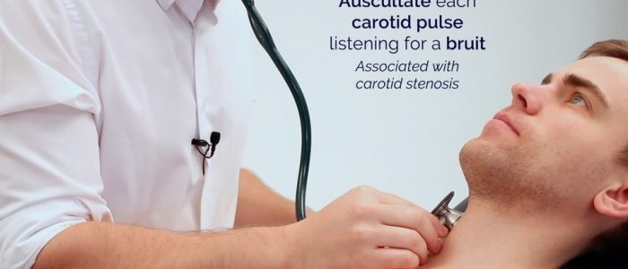 Carotid bruit auscultation