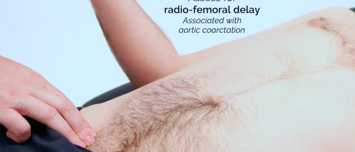 Radio-femoral delay
