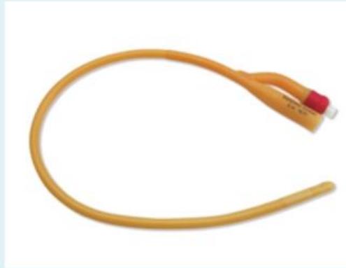 Foley Catheter with Inflated Balloon