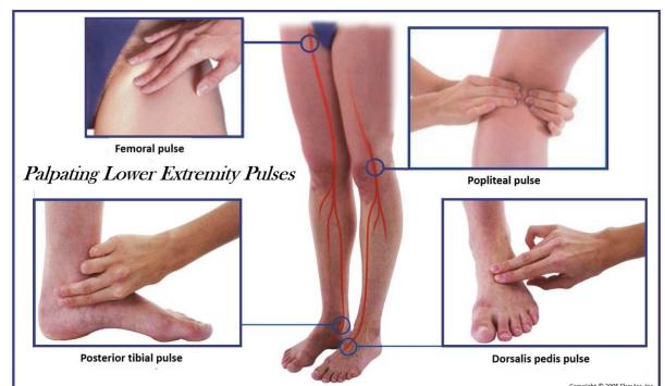 Palpating lower limb pulses