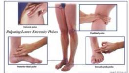 Lower limb arterial pulses