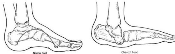 Ulcer measurement