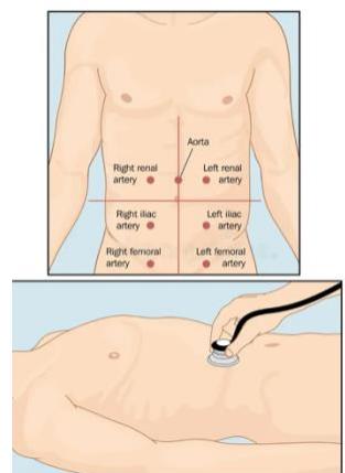 Aortic bruit auscultation