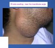 img-2.jpeg